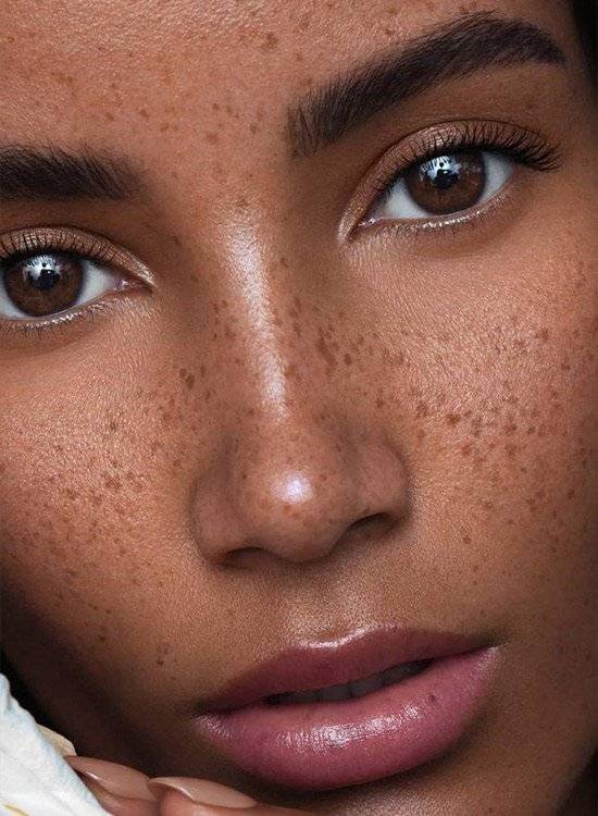 Formation Tâches de rousseurs