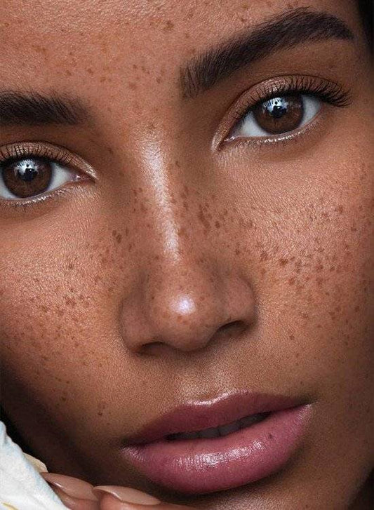 Formation Tâches de rousseurs